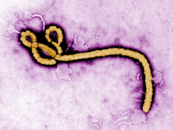 Ebola virus: Life cycle and pathogenicity in humans - ASK Scientific- English research manuscript editing, translation and research communications services
